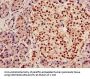 AGPAT5 Antibody