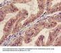 AGPAT5 Antibody