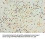 Rabbit anti-human Anterior gradient protein 2 homolog polyclonal Antibody(AGR2)