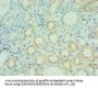 Rabbit anti-human Anterior gradient protein 2 homolog polyclonal Antibody(AGR2)