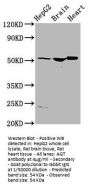 AGT Antibody