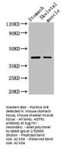 AGTR1 Antibody
