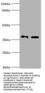 AKR1C4 Antibody