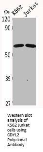 CDYL2 Antibody