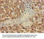 ALAS1 Antibody