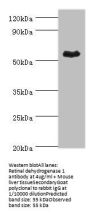 ALDH1A1 Antibody