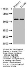 ALDH6A1 Antibody