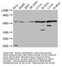 ALDH7A1 Antibody