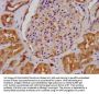 ALDH7A1 Antibody