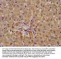ALDH7A1 Antibody