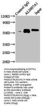ALDH7A1 Antibody