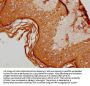 ALOX12B Antibody