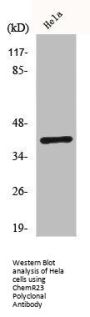 CMKLR1 Antibody