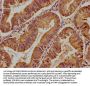 ALOX15 Antibody