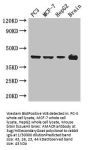 AMACR Antibody