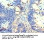 AMY2A Antibody
