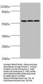 AMY2B Antibody