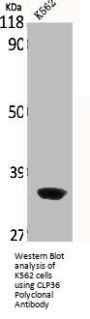 PDLIM1 Antibody