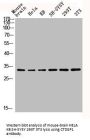 CTDSP1 Antibody