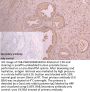 ANXA11 Antibody