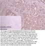 ANXA11 Antibody