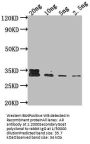 AR Antibody