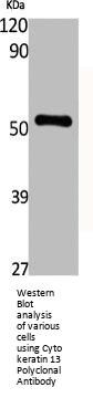 KRT13 Antibody