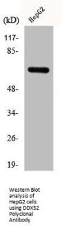 DDX52 Antibody