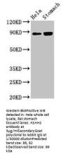 ASAH2 Antibody
