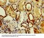 ASAH2 Antibody