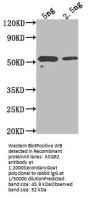 ASGR2 Antibody