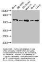 ASNS Antibody