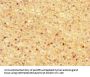 ASPN Antibody