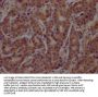 ATF4 Antibody