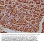 ATF5 Antibody