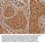 ATF5 Antibody