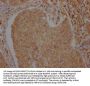 ATF6 Antibody