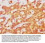 ATOX1 Antibody