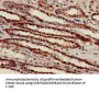 ATP5B Antibody