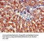 ATP5B Antibody