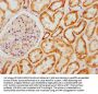 ATP5L Antibody