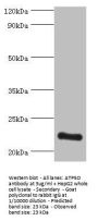 ATP5O Antibody