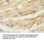ATP5O Antibody