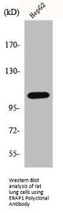 ERAP1 Antibody
