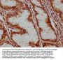 ATP6V1C1 Antibody