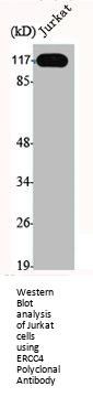 ERCC4 Antibody