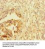 ATRX Antibody