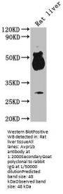 Avpr1b Antibody
