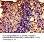 AVPR2 Antibody