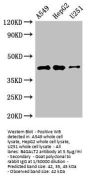 B4GALT2 Antibody